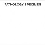 Item# V-LS401  ‘Pathology Specimen’ Label